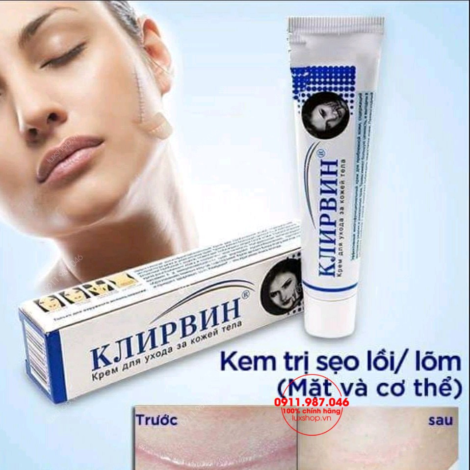 kem trị sẹo Nga, kem trị seo Klirvin, kem trị sẹo mụn, kem trị sẹo thâm