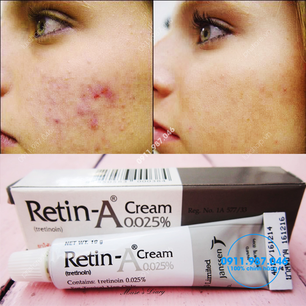 Thuốc Retin-A Cream 0.025% Tretinoin chuyên điều trị mụn bọc mụn ẩn chính hãng (Thái Lan)