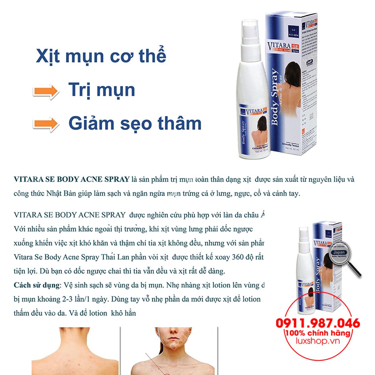  Xịt trị mụn lưng Vitara SE Body Acne Spray 50ml chính hãng (Thái Lan)